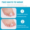 Nolimvita Hammer Toe Straightener Corrector - Toe Spacers Toe Splints