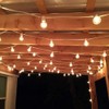 Romasaty 25FT String Lights, G40 Outdoor String Lights Edison Light
