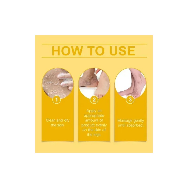 2pcs Crema Elimina Varices Desinflama Venas