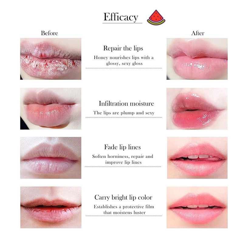 6 PCS Bee Lip Balm Honey Pot, Strawberry & Watermelon