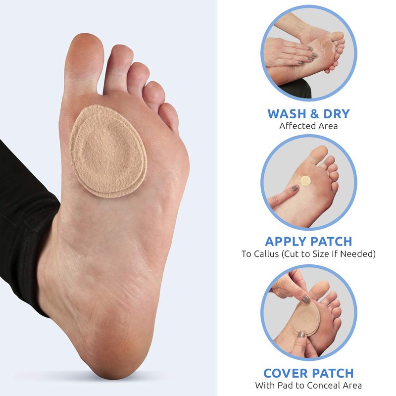 Comfort Zone Extra Thick Callus Remover Pads for Feet, Contains