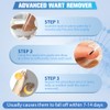 Natural Care Solution – Suitable for Hands, Feet, Neck, and