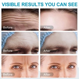 16PCS Forehead Wrinkle Patches, Collagen Forehead Anti Wrinkle Patches with potent anti-aging agents, for Fine Lines & Frown Lines,Moisturizing forehead & between eyes