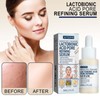 Xiulilydai Lactobionic Acid Pore Refining Serum, 30ml, Shrink Pores, Reduce