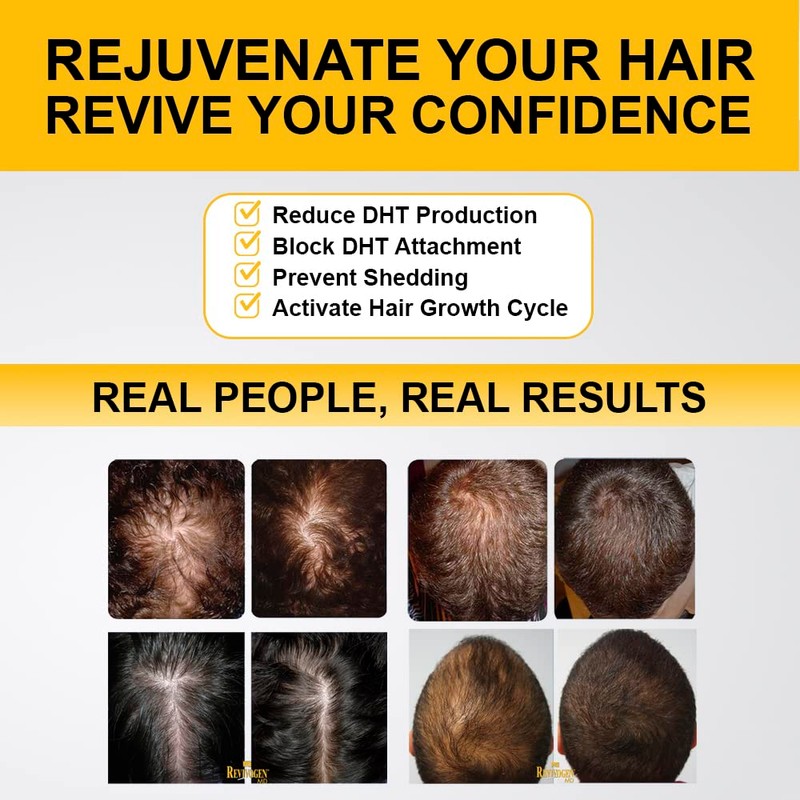 Revivogen MD Scalp Therapy Thinning Hair Solution, Shampoo & Conditioner