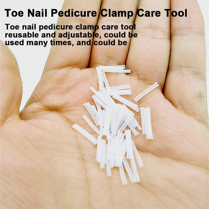 2 Piece Set Ingrown Toenail Correction Strips Brace Kit Ingrown