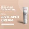 DERMOTEN Anti-Blemish & Brightening Cream, Advanced Dark Spot Corrector, Dermatologically