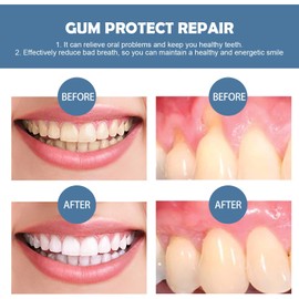 30ml*2pcs Mullend Gum Repair Gel,Mullend Teeth Repair Gel for Receding Gums,Natural Gum Protect Re/Pair Toothpaste Supports Gu/m Regrowth,White Tooth R/epair G/um Shield G/um R/epair G/el Treatment