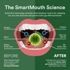 SmartMouth Activated Dry Mouth Mouthwash, Dry Mouth and Bad Breath