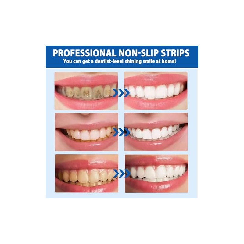 28PCS Tiras Blanqueadoras Dentales 9D, Teeth Whitening strips Anti-Deslizantes, Sabor