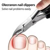 Professional Podiatrist Ingrown Toenail Nippers Large Metal Nail Clippers for