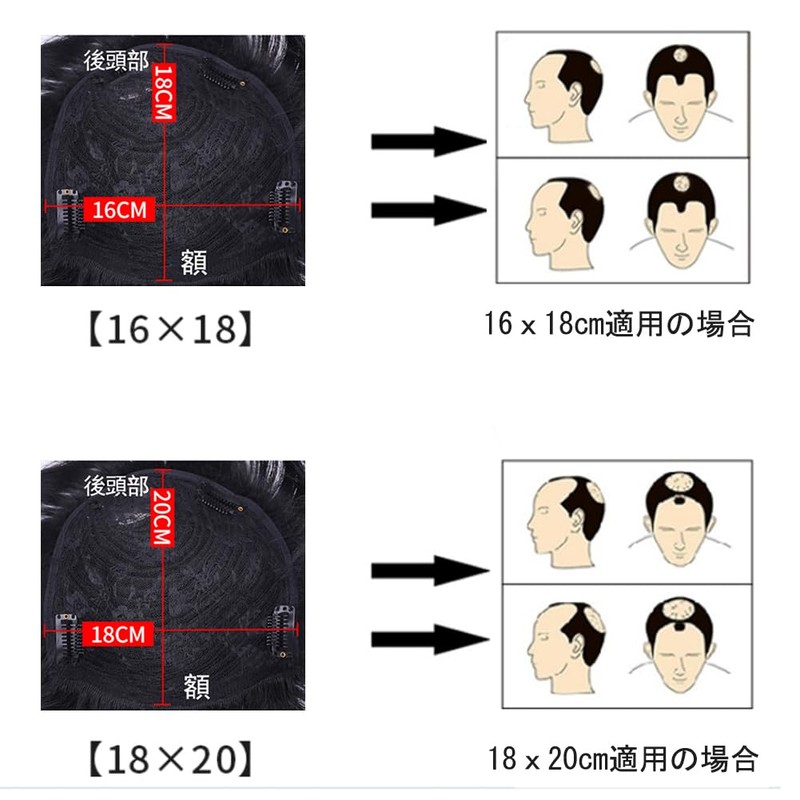 Sitengle 部分ウィッグ メンズ 頭頂部 人毛 男性用ウィッグ つむじはげ トップカバー ヘアトップピース 人工皮膚