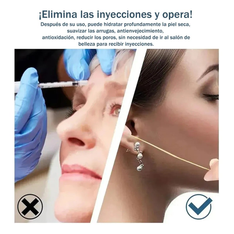 🔥 300 de colágeno absorbible de hilo de estiramiento facials
