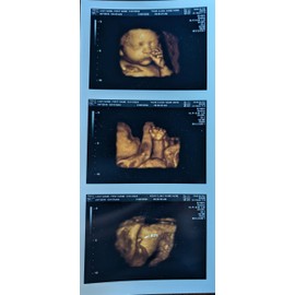 Prank 3D COLOR Customized Fake Ultrasound Strip of 3 Photos