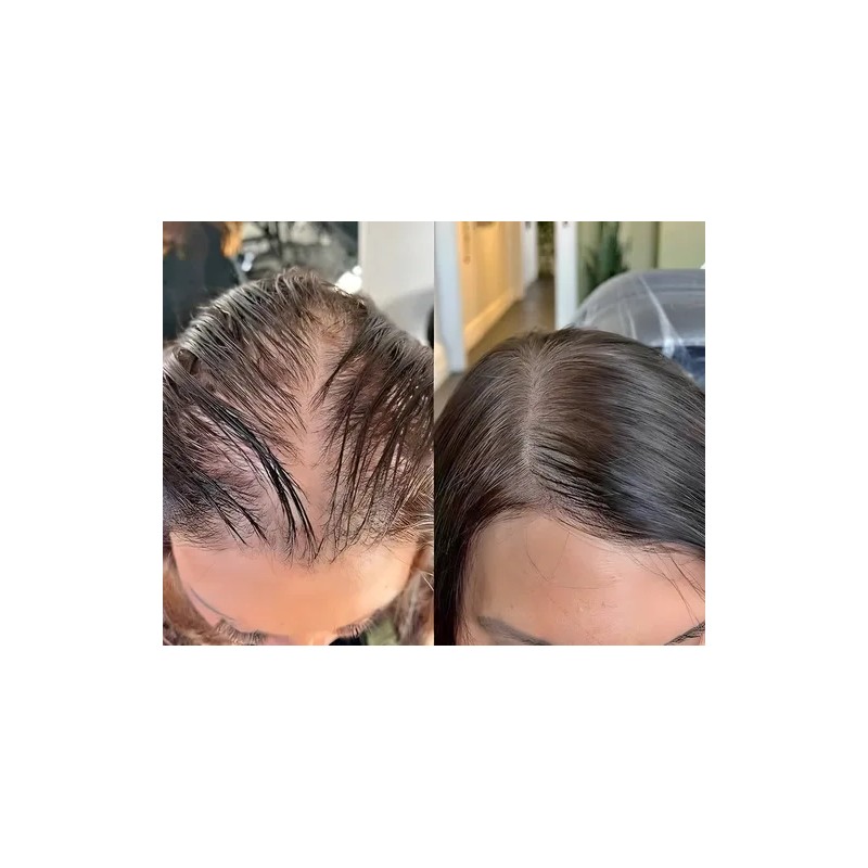 Shampoo Reviving Farmasi Caida Cabello