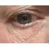 Instantly Erase eye bags —Cream – 25 Vials under eye