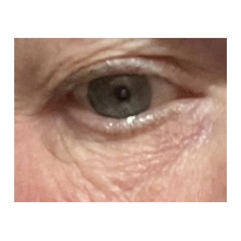 Instantly Erase eye bags —Cream – 25 Vials under eye