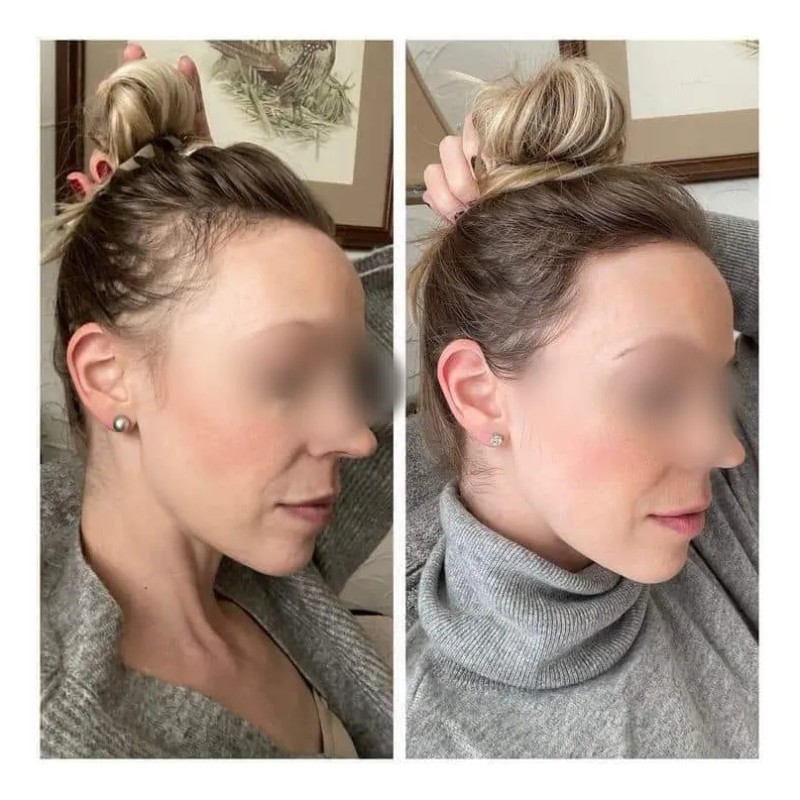 2pzs Shampoo Reviving Farmasi/para Crecimiento De Cabello