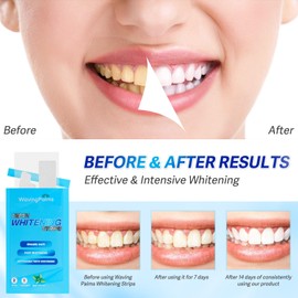 Waving Palms Teeth whitening Strips for Tooth White: Professional Dental Teeth whitening Strips - 28 whitening Strips- White Strips for Teeth whitening for The Perfect Smile, Blue