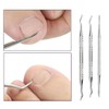 [BZ7JJ3I4_56] Ingrown Toenail Trimmer Curette 3-Piece Set (35987835) / [BZ7JJ3I4_56]파고드는발톱 발톱정리기 큐렛3종세트 (35987835)