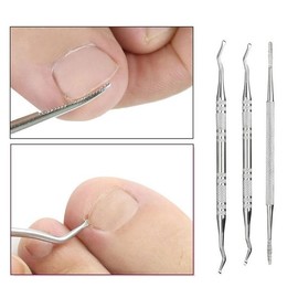[BZ7JJ3I4_56] Ingrown Toenail Trimmer Curette 3-Piece Set (35987835) / [BZ7JJ3I4_56]파고드는발톱 발톱정리기 큐렛3종세트 (35987835)