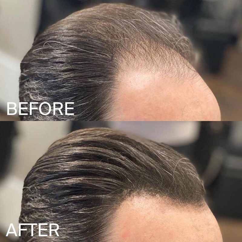 HLS Hair Fibres Light Brown | Powder for Thinning 25g