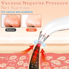 PQETBV Blackhead Remover with 5 Modes, Pore Cleanser Face for Deep Cleansing, Face Care for All Skin Types, Ideal for Removing Blackheads, Acne, Blemishes