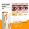 Turmeric Retinol Eye Stick,Eye Balm Stick Hydrating for Dark Circle,Wrinkles,Visible