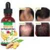 Evitar La Caida Del Cabello Aceite Biotina Para Ayudar Evitar