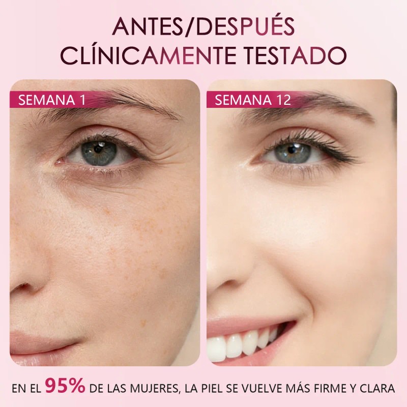Suero Facial con Retinol – Anti-Edad, Rejuvenece y Reduce Manchas