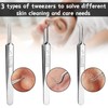 Set of 3 pimple tweezers, blackhead tweezers, precision, pimple tool