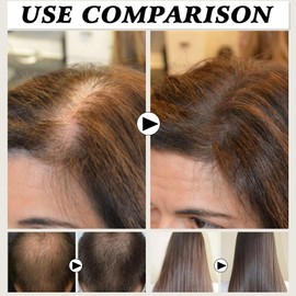 2PCS Deoxyribose Sugar Gel Hair Growth, Deoxy Ribose Sugar Hair Growth 60ml, Hair Growth Serum