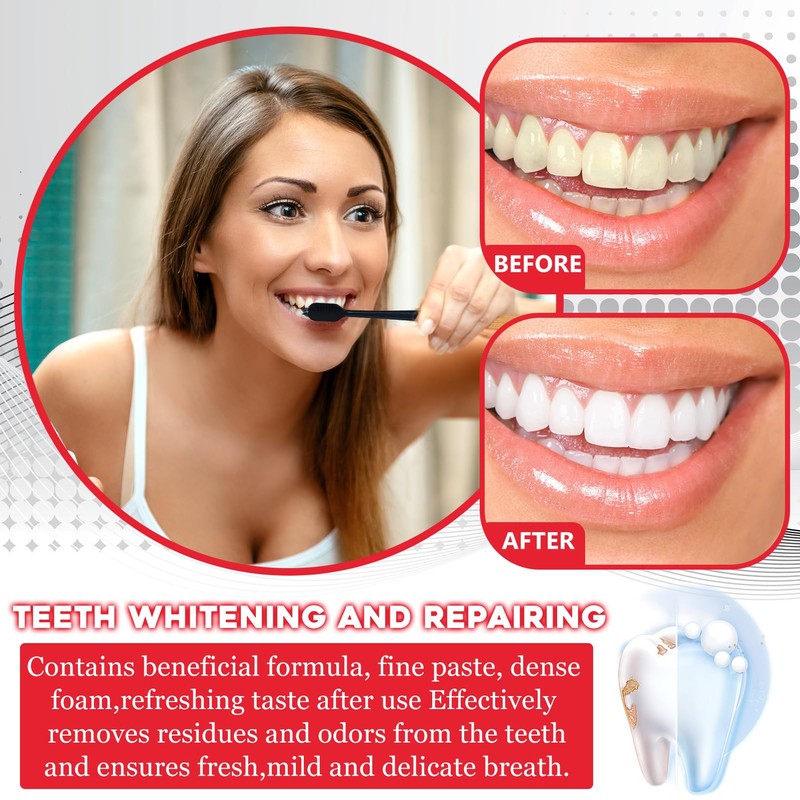 Pack of 2 Sp-6 Toothpaste, Sp-6 Probiotic Toothpaste, Whitening Toothpaste,