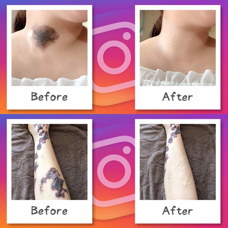 Foundation Tape (Hide Tattoo Stickers) Large Size Same Color 5