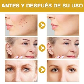 2pcs Advanced snail mucin power essence 100 Ml，Snail Mucin Essence，Esencia hidratante facial, potentemente hidratante, de fácil absorción, indicada pa