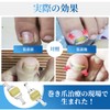 巻き爪器具 2個入り 巻き爪 まきづめ 陥入爪 まきずめ 巻爪 器具 オリジナル説明書付属 (16-18mm)