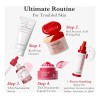 Limpiador De Espuma Roja Medicube, Limpia En Profundidad