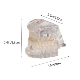 BUGUUYO Detachable Oral Model for Dental Teaching Removable Disease Teeth Demonstration Model for Dental Study and Training