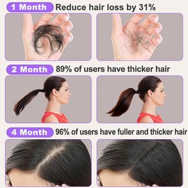 Hair Growth Shampoo & Conditioner Set with Scalp Massager for Hair Loss - Sulfate Free with Rosemary, Keratin & Biotin shampoo suppository