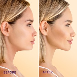 MAREE Classic V Lifting Mask – Firming Face Slimming Strap for Daily Use