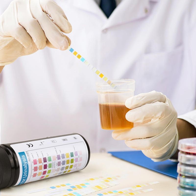 Urine Test Strips 11 Parameters 100 Count