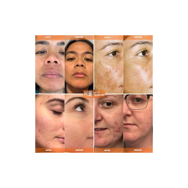 AVYA Skincare Suero de poder antienvejecimiento - Tamaño de viaje,