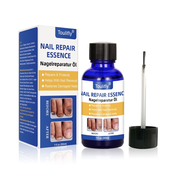 Nail Care and Treatment, Nail Repair, Nail Care for Healthy Foot and Hand, Nail Oil, Nail Care Oil, Nail Care Nourishing, Nail Essence Serum, For Broken and Discoloured Nails