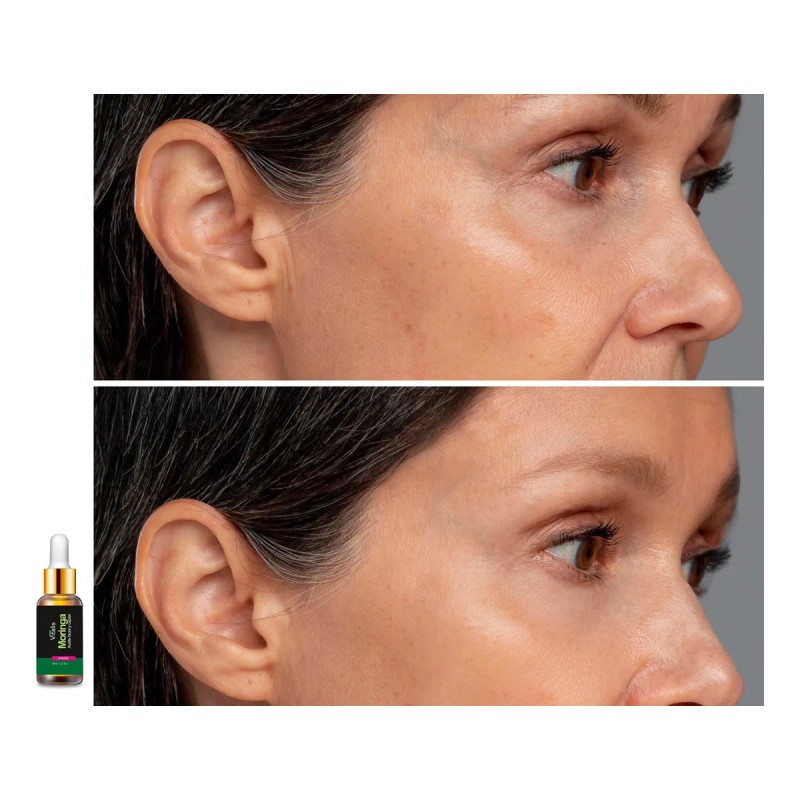 3 Aceite De Moringa Antiarrugas Anti Manchas Antiedad Natura