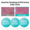 numbuzin No.1 Toner | Pure-Full Soothing Toner | Acne Prone