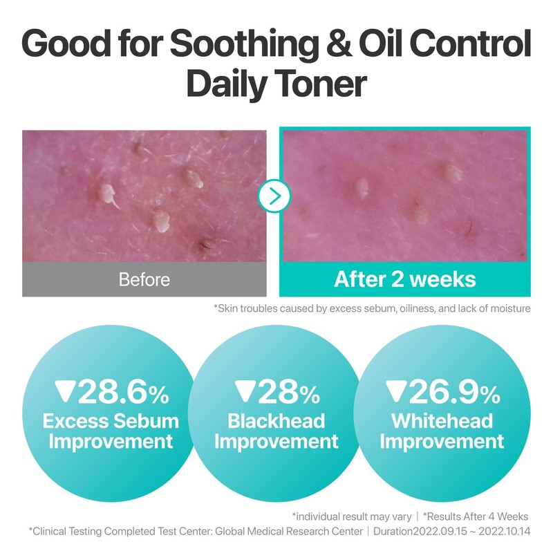numbuzin No.1 Toner | Pure-Full Soothing Toner | Acne Prone