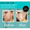Niacinamida Serum 12% Plus Zinc 2% - 1oz from Naturium