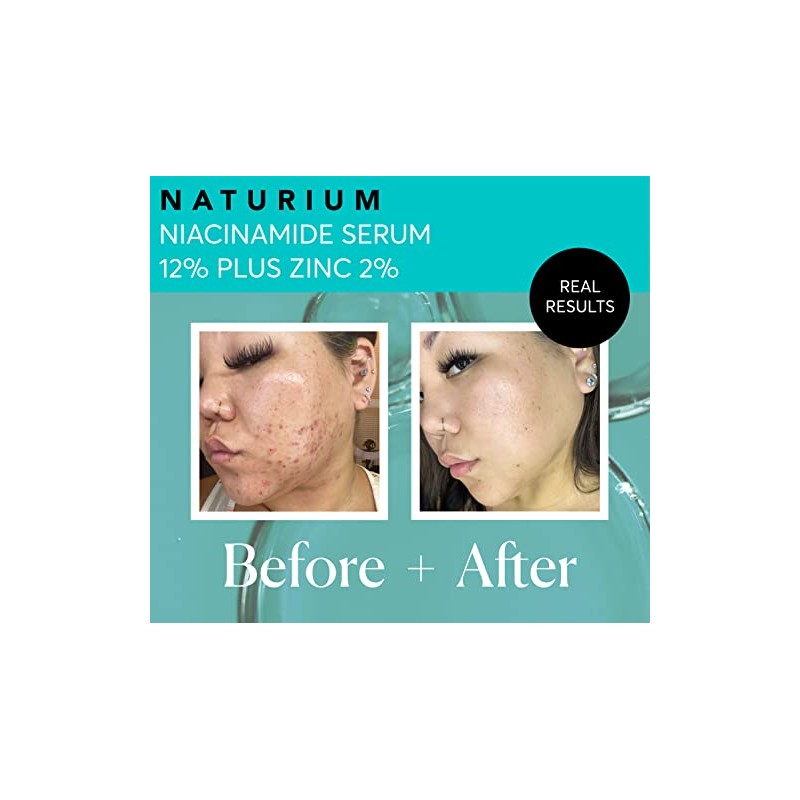 Niacinamida Serum 12% Plus Zinc 2% - 1oz from Naturium