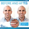 Instant Smile Complete Your Smile Temporary Tooth Replacement Kit with