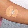 myDili Plaster Tape Patch for Medtronic Guardian Sensor DiaTape Classic